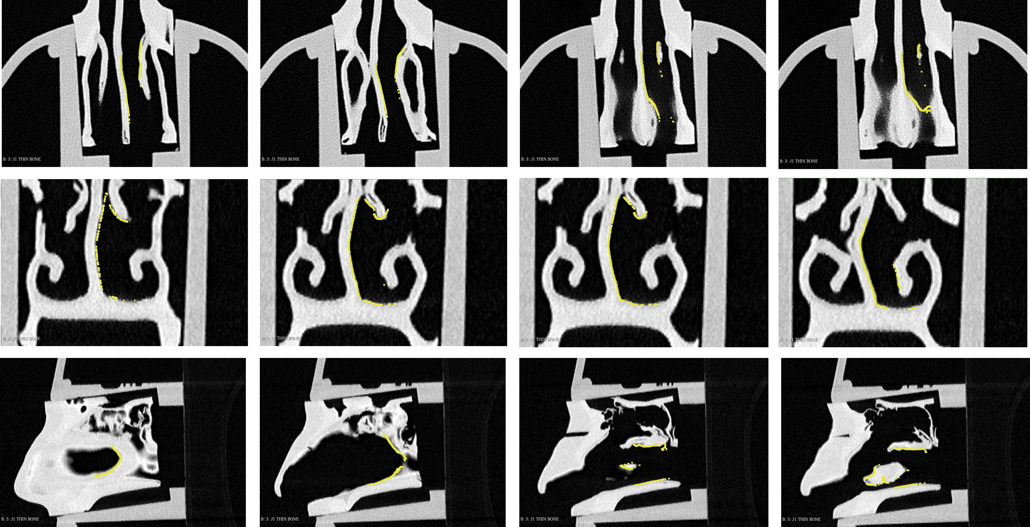 CT comparison demonstration